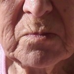 Elderly skin is wrinkled & weathered.